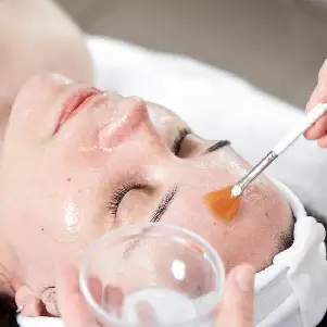 Chemical Peel medicine